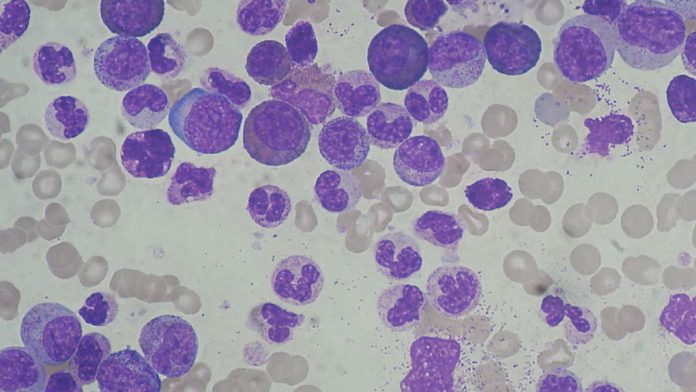 Leucemia mieloide