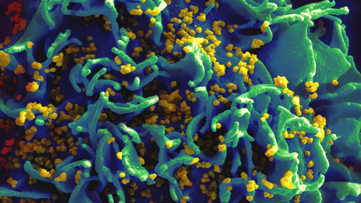 Una investigación revela que solo el 13% de los españoles diagnosticados con VIH lo comunica abiertamente