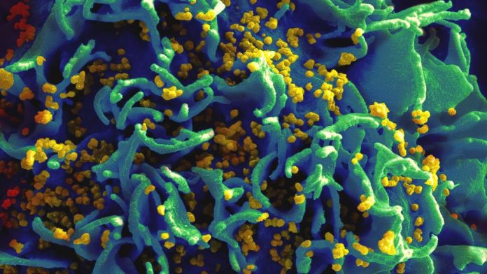 Micrografía electrónica de barrido de partículas de VIH que infectan una célula T humana