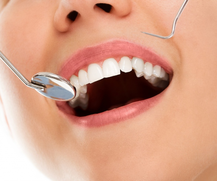 Detalle de boca de mujer en el dentista